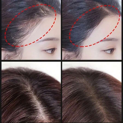 SOMBRAS CUBRE CANAS ¡UNA SOLUCIÓN INMEDIATA! + GRAN PROMO DE 2 UNIDADES