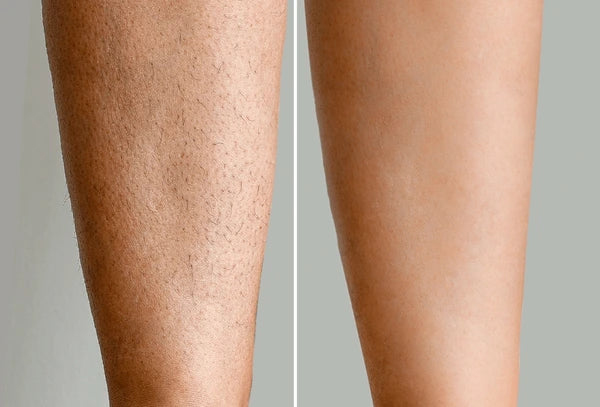 Serum inhibidor de vello corporal - Ayuda a debilitar el vello desde la raíz, calma, nutre y suaviza la piel tras la depilación - ¡luce tu piel más suave y radiante!