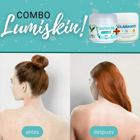 💎 LUMISKIN® ¡🔥 DI ADIÓS AL ACNÉ Y MANCHAS EN TU ESPALDA! + GRAN COMBO