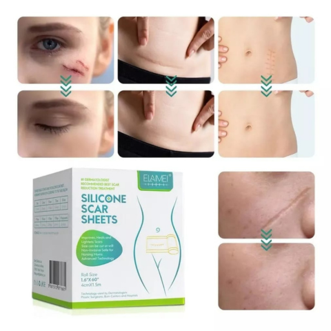 ✨ DERMAHEAL CINTA CICATRIZANTE® ¡PROTECCIÓN INVISIBLE , CONFIANZA VISIBLE! + PROMO DE 2 UNIDADES