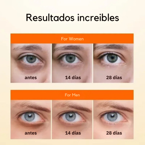 Serum para ojeras con vitamina C -Reafirma, hidrata y unifica el color - ¡Gran promoción dos unidades!