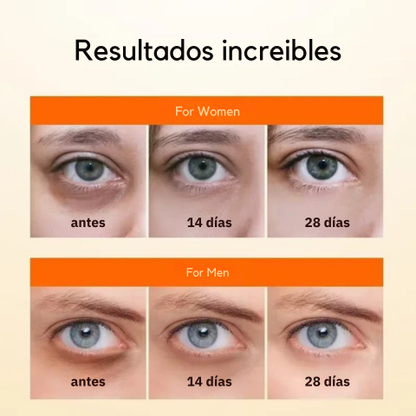 Serum para ojeras con vitamina C -Reafirma, hidrata y unifica el color - ¡Gran promoción dos unidades!