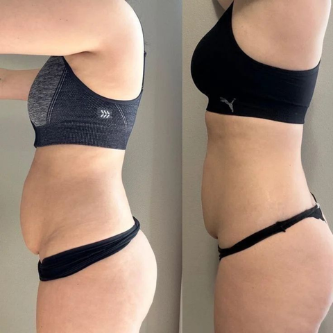 PENDIENTES VITALPRESS ✨ ¡BAJA 5 KILOS EN UN MES! + PDF   DE HABITOS SALUDABLES