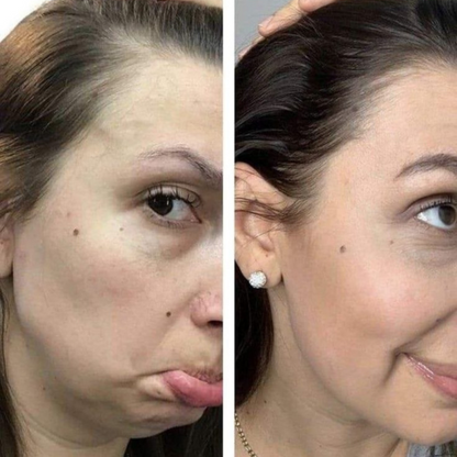 TRATAMIENTO ANTICAIDA Y FORTALECIMIENTO  ¡UN CABELLO RADIANTE Y HERMOSO! + GRAN PROMOCIÓN 2X1 Y ENVÍO GRATIS