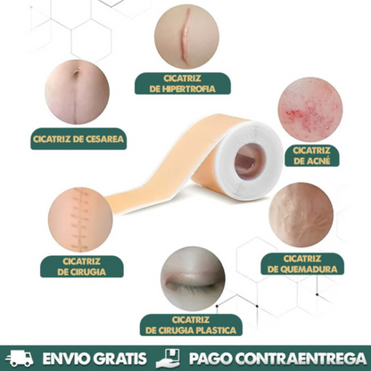 ✨ DERMAHEAL CINTA CICATRIZANTE® ¡PROTECCIÓN INVISIBLE , CONFIANZA VISIBLE! + PROMO DE 2 UNIDADES