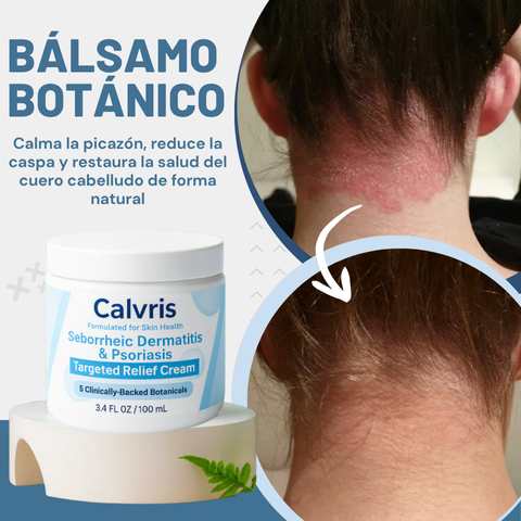 Bálsamo botánico - ayuda a calmar la caspa, la psoriasis y la dermatitis del cuero cabelludo + 50% DCT