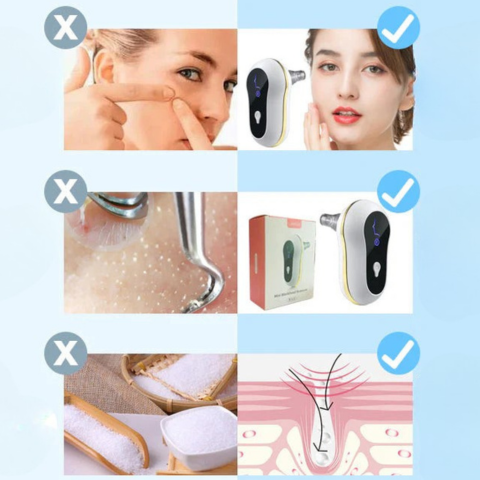 LIMPIADOR FACIAL ¡UN MEJOR CUIDADO PARA TU PIEL! + ENVÍO GRATIS
