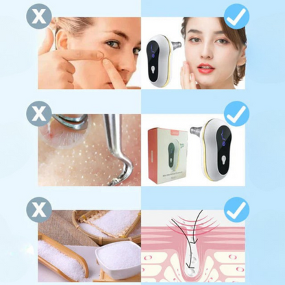 LIMPIADOR FACIAL ¡UN MEJOR CUIDADO PARA TU PIEL! + ENVÍO GRATIS