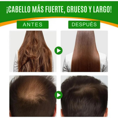 🌿 ACEITE DE BATANA ¡EL SECRETO PARA UN CABELLO ABUNDANTE Y SALUDABLE ✨! + OFERTA 2X1