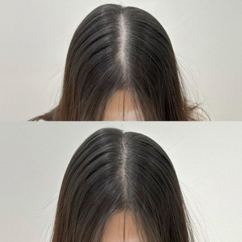 TRATAMIENTO ANTICAIDA Y FORTALECIMIENTO  ¡UN CABELLO RADIANTE Y HERMOSO! + GRAN PROMOCIÓN 2X1 Y ENVÍO GRATIS