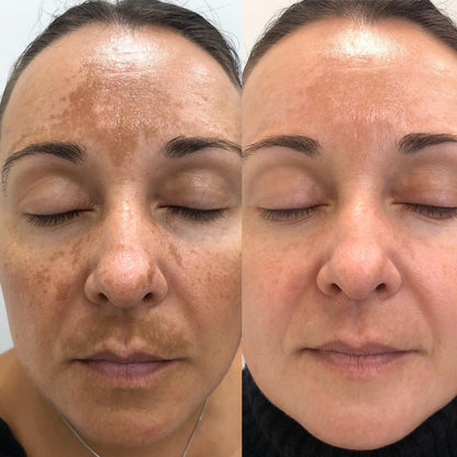 Crema Facias Dr. Melaxin - Ayuda a reducir manchas, mejora la textura cutánea y equilibra el tono de la piel - ¡Unifica tu piel hoy!