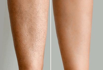 Serum inhibidor de vello corporal - Ayuda a debilitar el vello desde la raíz, calma, nutre y suaviza la piel tras la depilación - ¡luce tu piel más  suave y radiante!