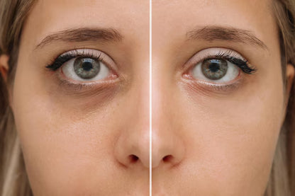 Serum para ojeras con vitamina C -Reafirma, hidrata y unifica el color - ¡Gran promoción dos unidades!